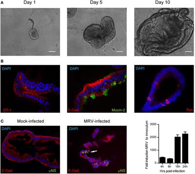 Type I and Type III Interferons Display Different Dependency on Mitogen-Activated Protein Kinases to Mount an Antiviral State in the Human Gut